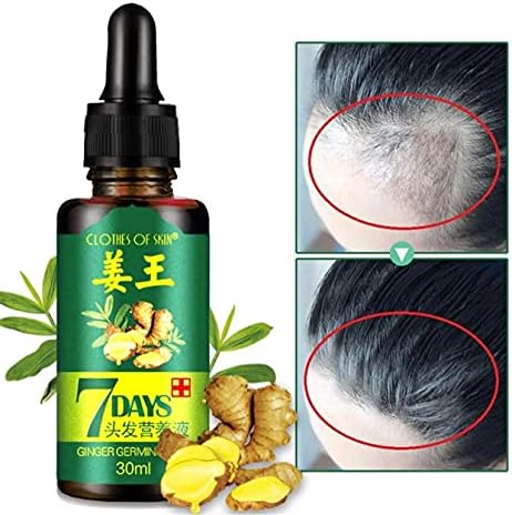 Xtreme Hair Regrow 7 Day, Ginger Germinal Essential Oil Hair Growth Hair Loss Treatment Hair Care Hair Growth Serum for Men & Women, 30ML